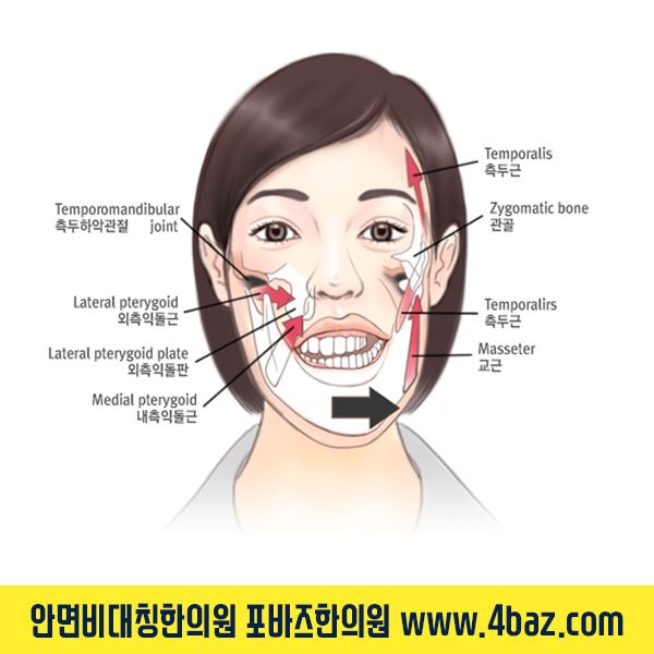 안면비대칭한의원02.png