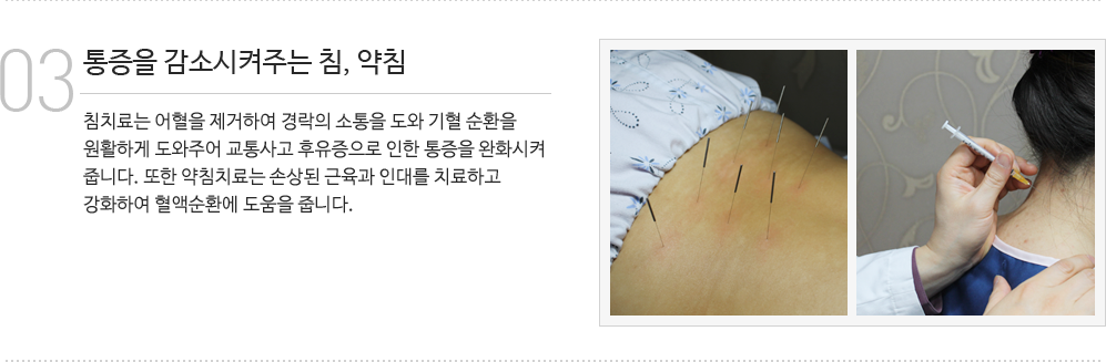 침, 약침