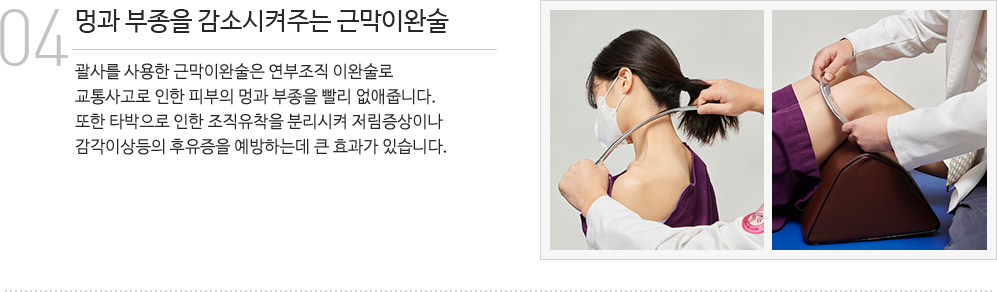 근막이완술