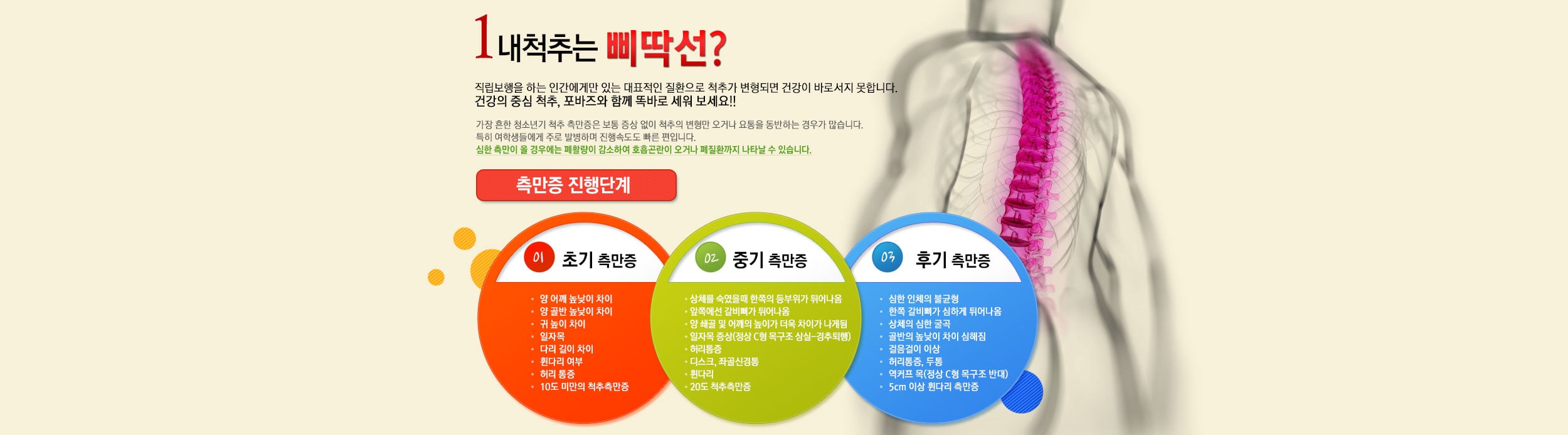 측만증 진행단계