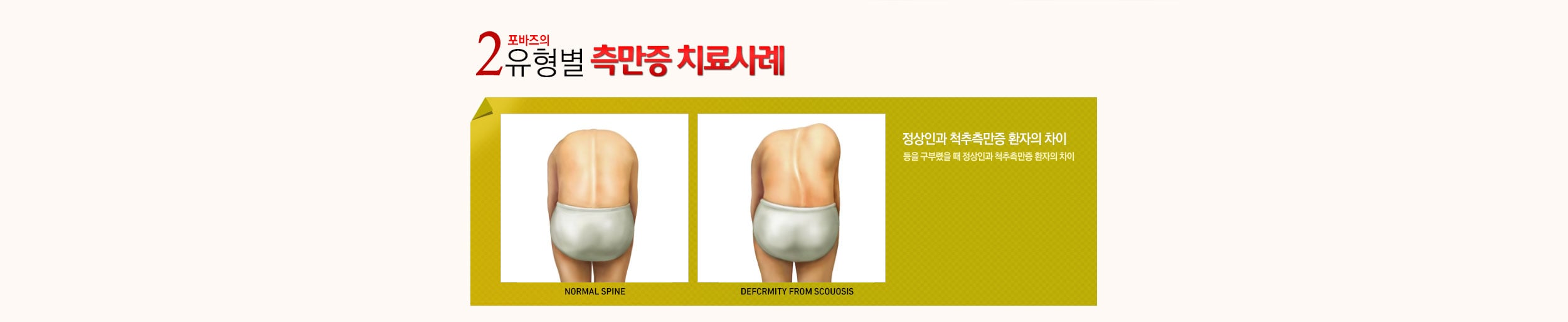 유형별 사례