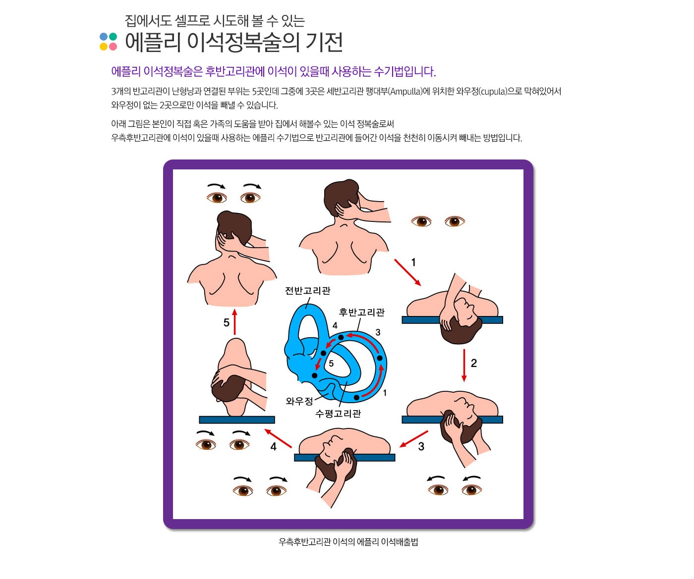 이석정복술
