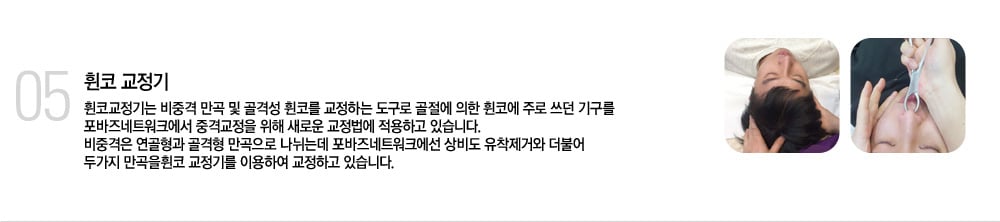 휜코 교정기