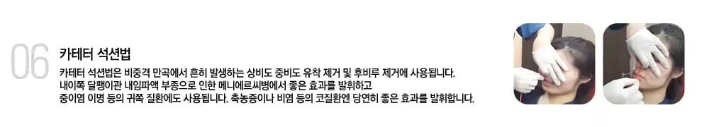 카테터 석션법
