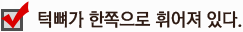 턱뼈가 한쪽으로 휘어져 있다.