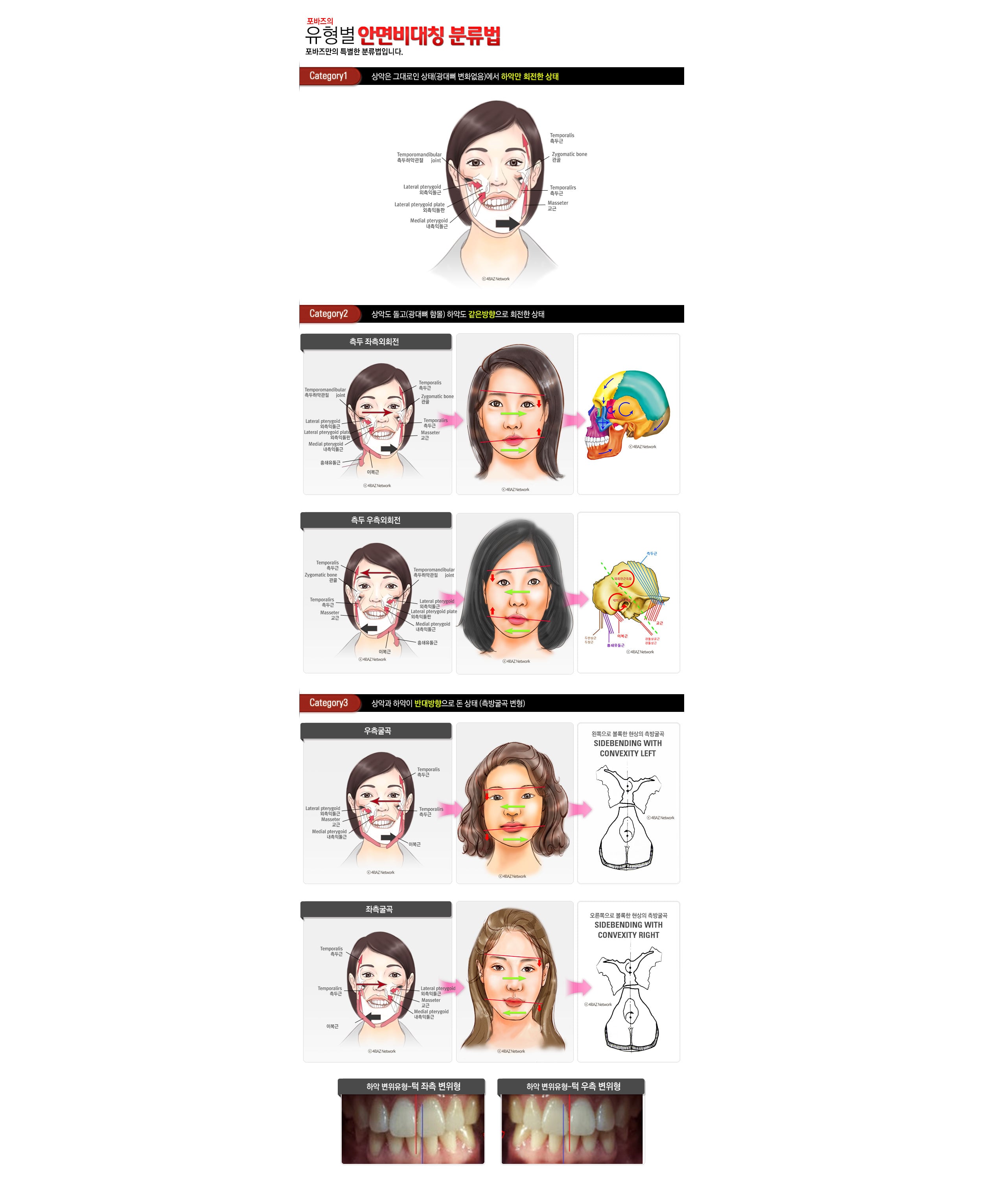 비대칭 분