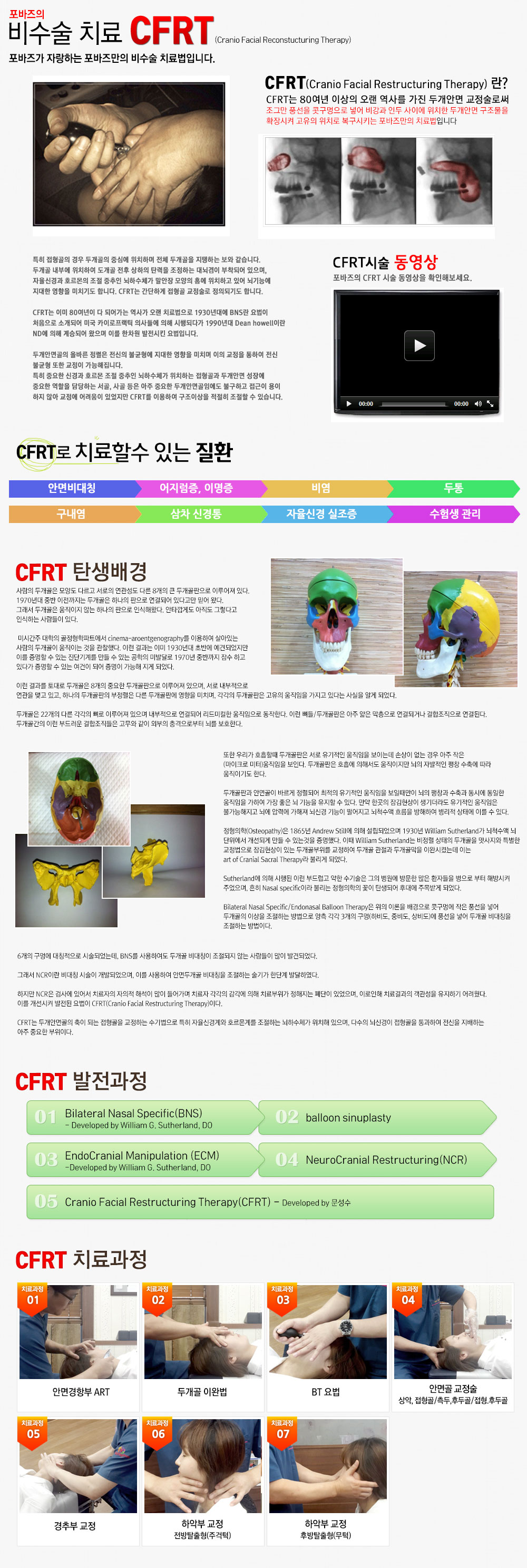 두개안면교정술 CFRT
