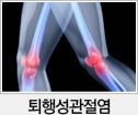 퇴행성관절염