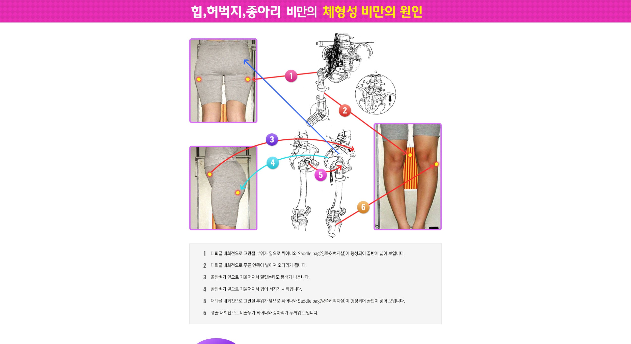 체형성 비만 원인