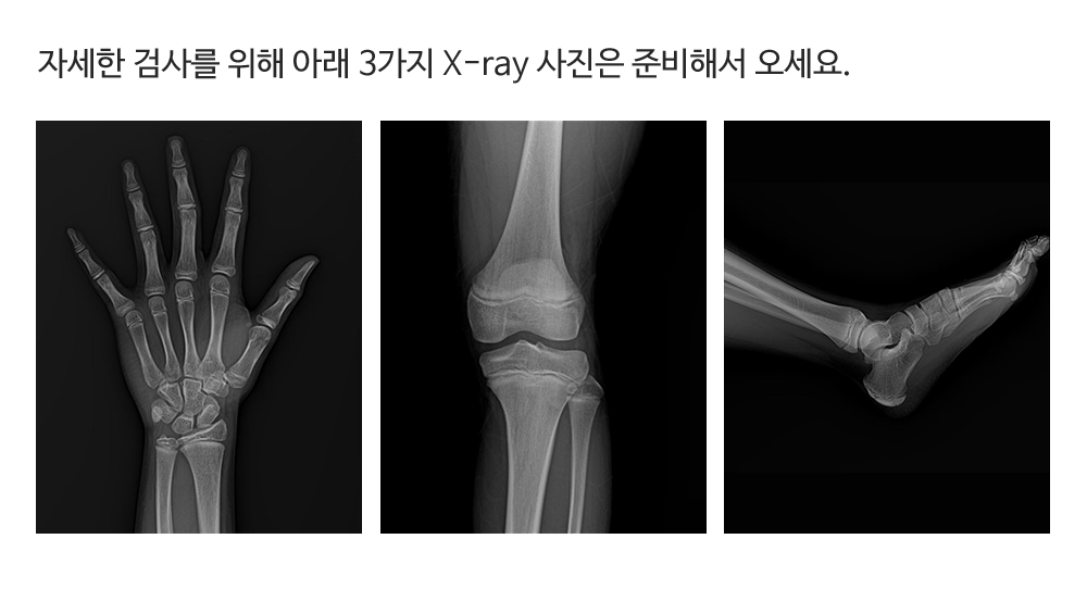 X-ray 준비물