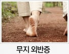 무지 외반증