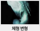 체형 변형
