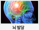 뇌 발달