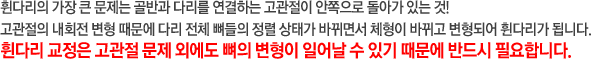 휜다리의 가장 큰 문제는 골반과 다리를 연결하는 고관절이 안쪽으로 돌아가 있는 것! 고관절의 내회전 변형 때문에 다리 전체 뼈들의 정렬 상태가 바뀌면서 체형이 바뀌고 변형되어 휜다리가 됩니다. 휜다리는 고관절 문제 외에도 뼈의 변형이 일어날 수 있기 때문에 교정이 반드시 필요합니다.
