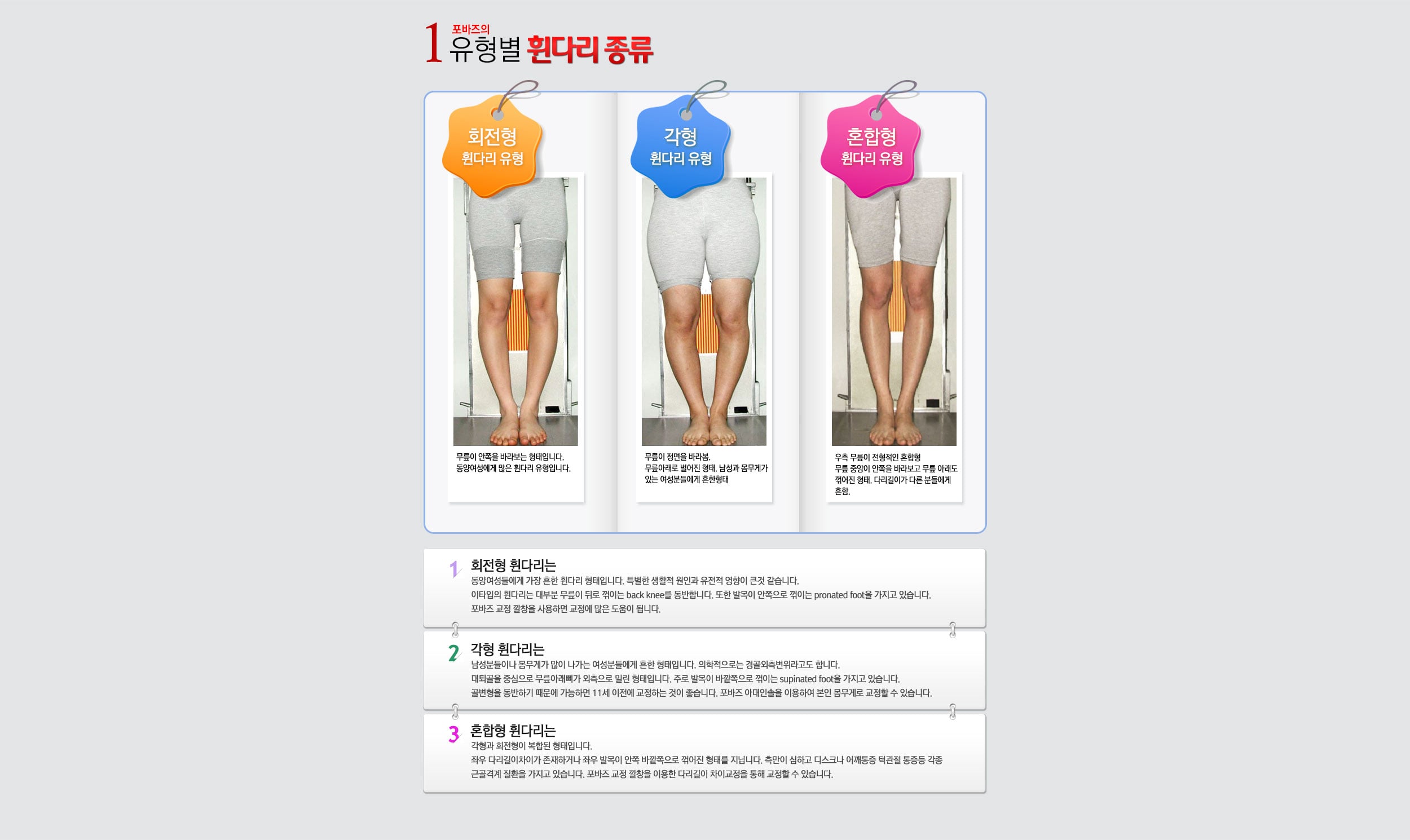 휜다리 유형