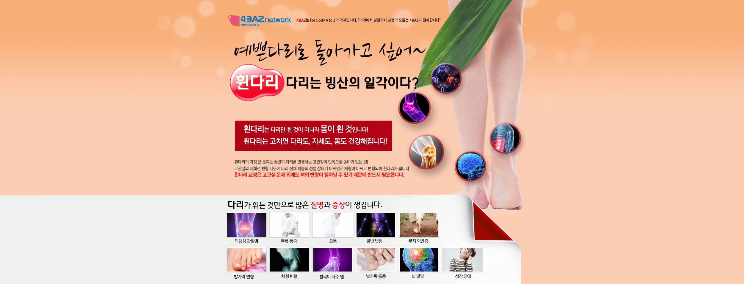 휜다리 교정 클리닉 소개
