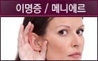 이명증/메니에르