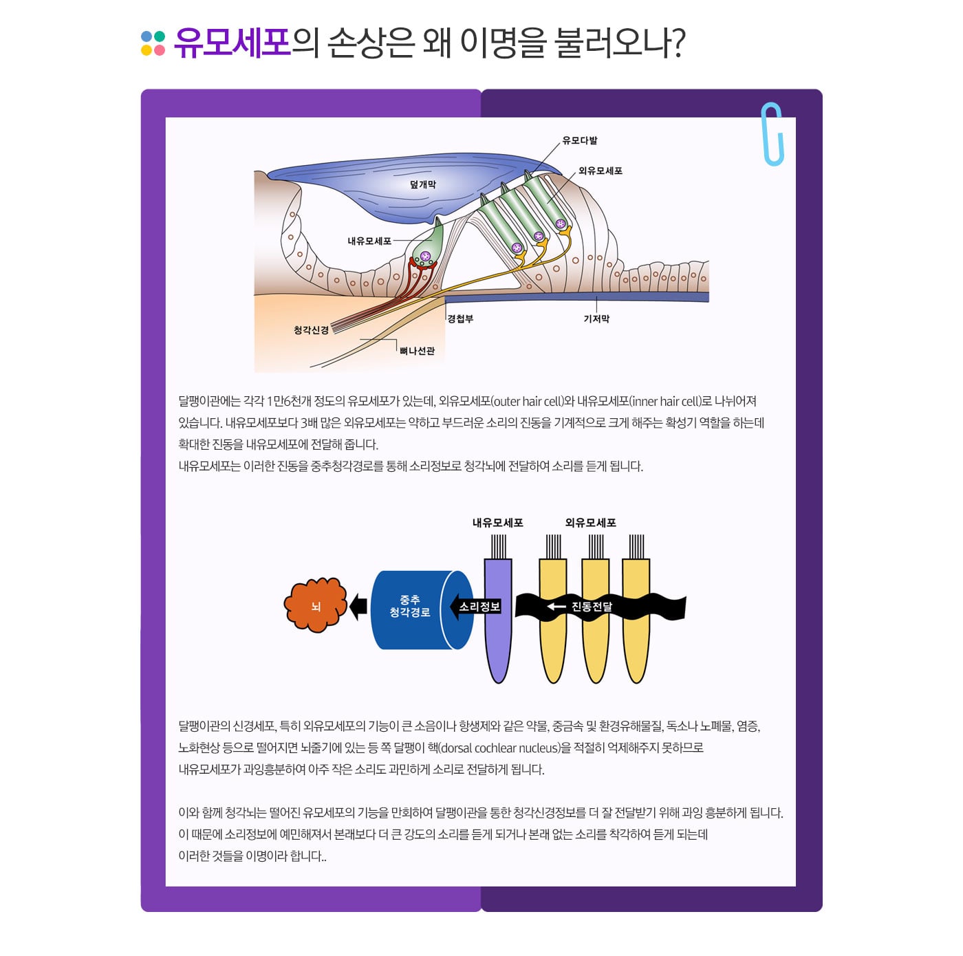유모세포 손상