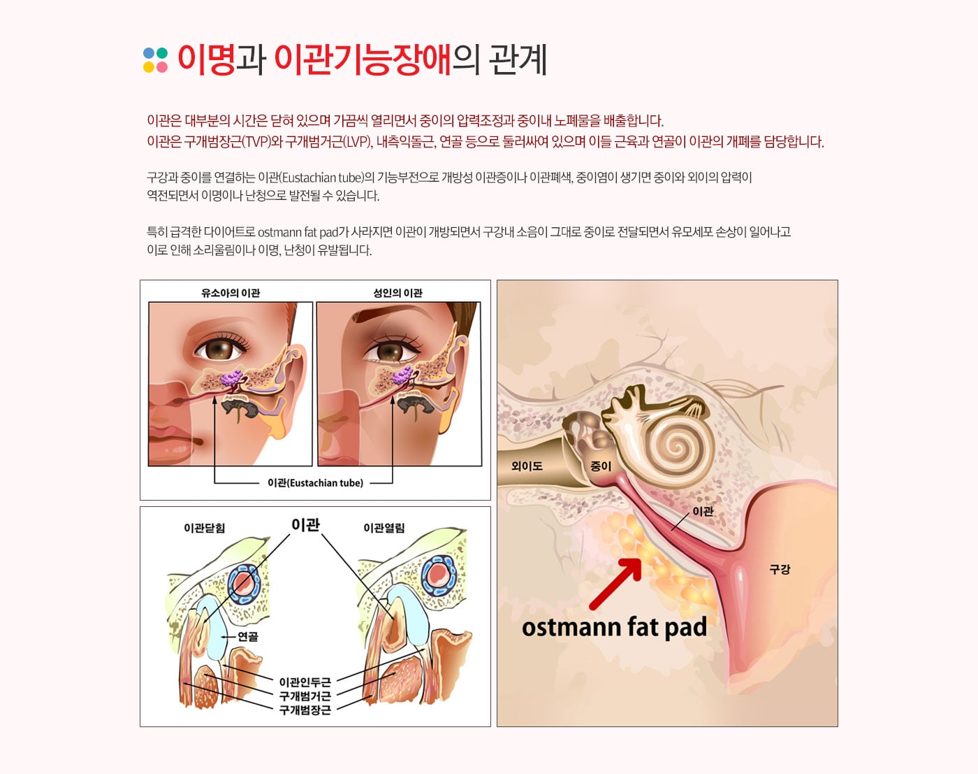 이관기능장애