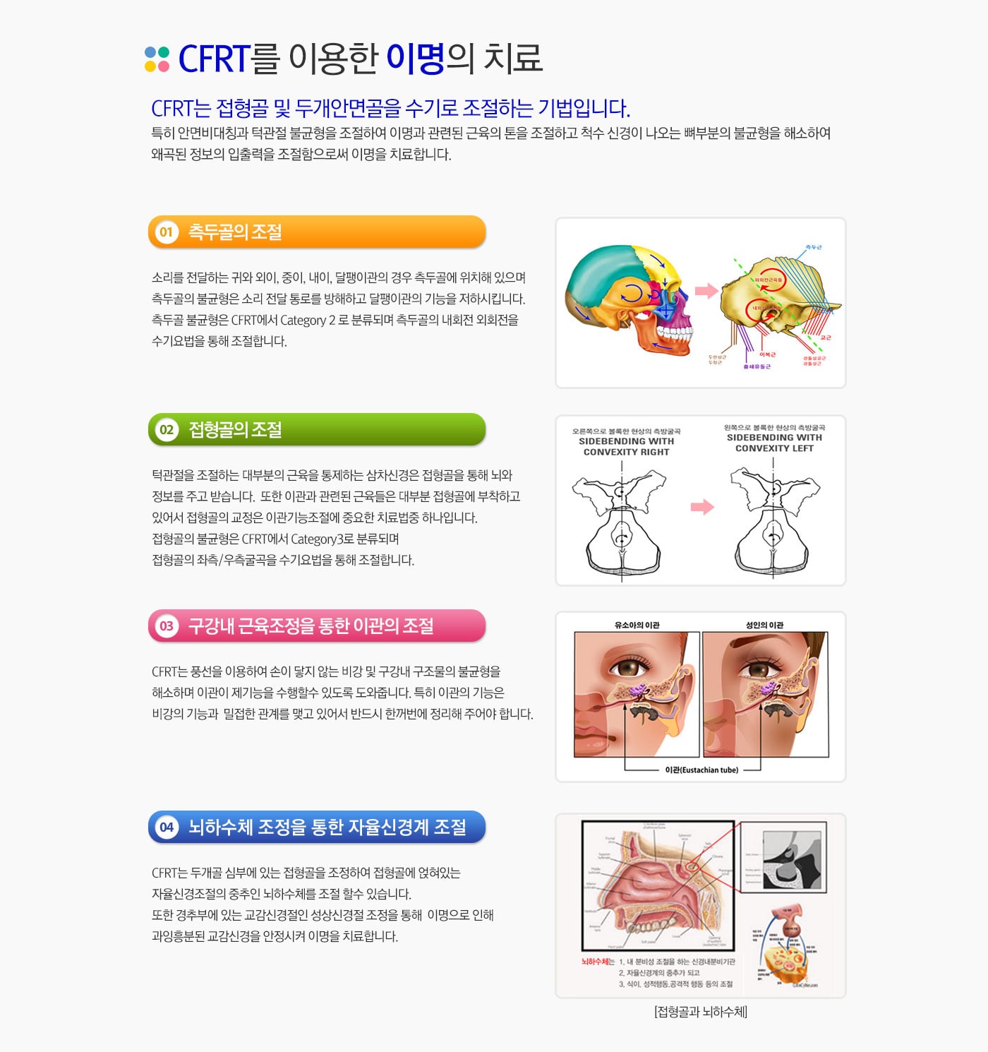 CFRT 치료