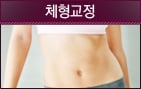 척추체형교정