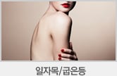 일자목/굽은등