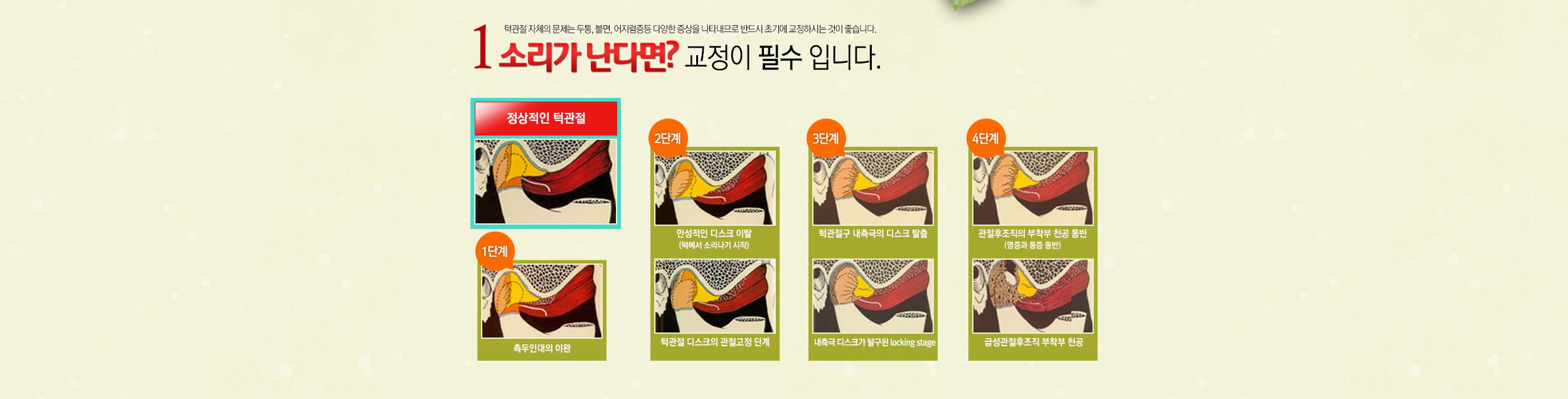 장애발생 과정