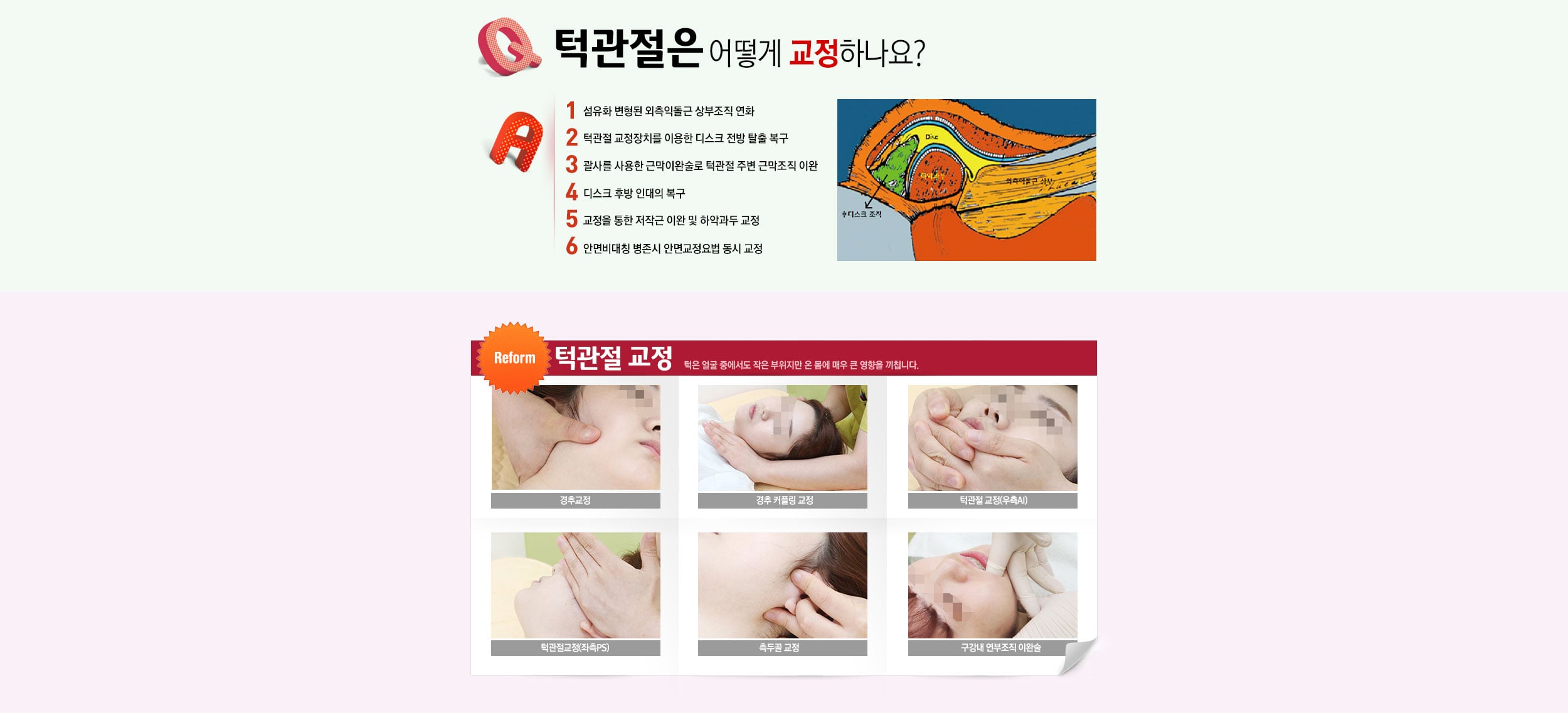턱관절 교정치료 원리