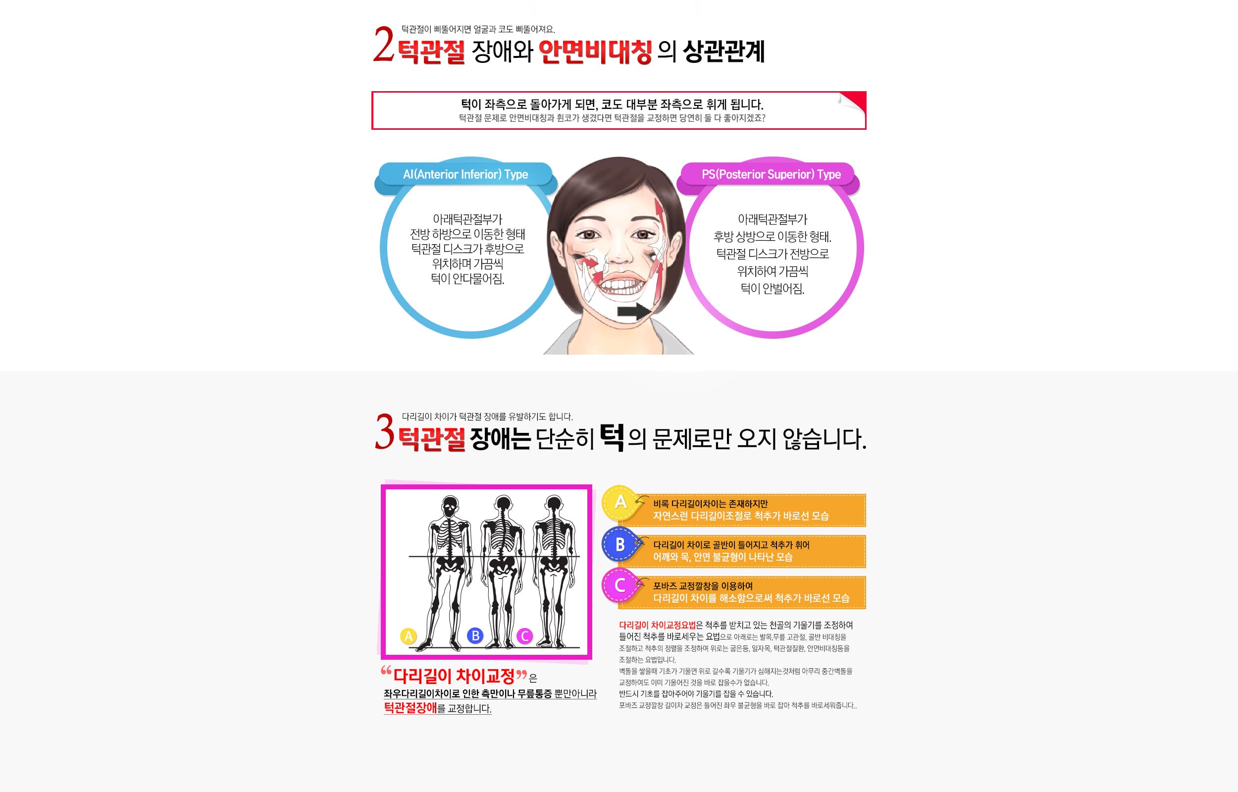 안면비대칭과의 상관관계