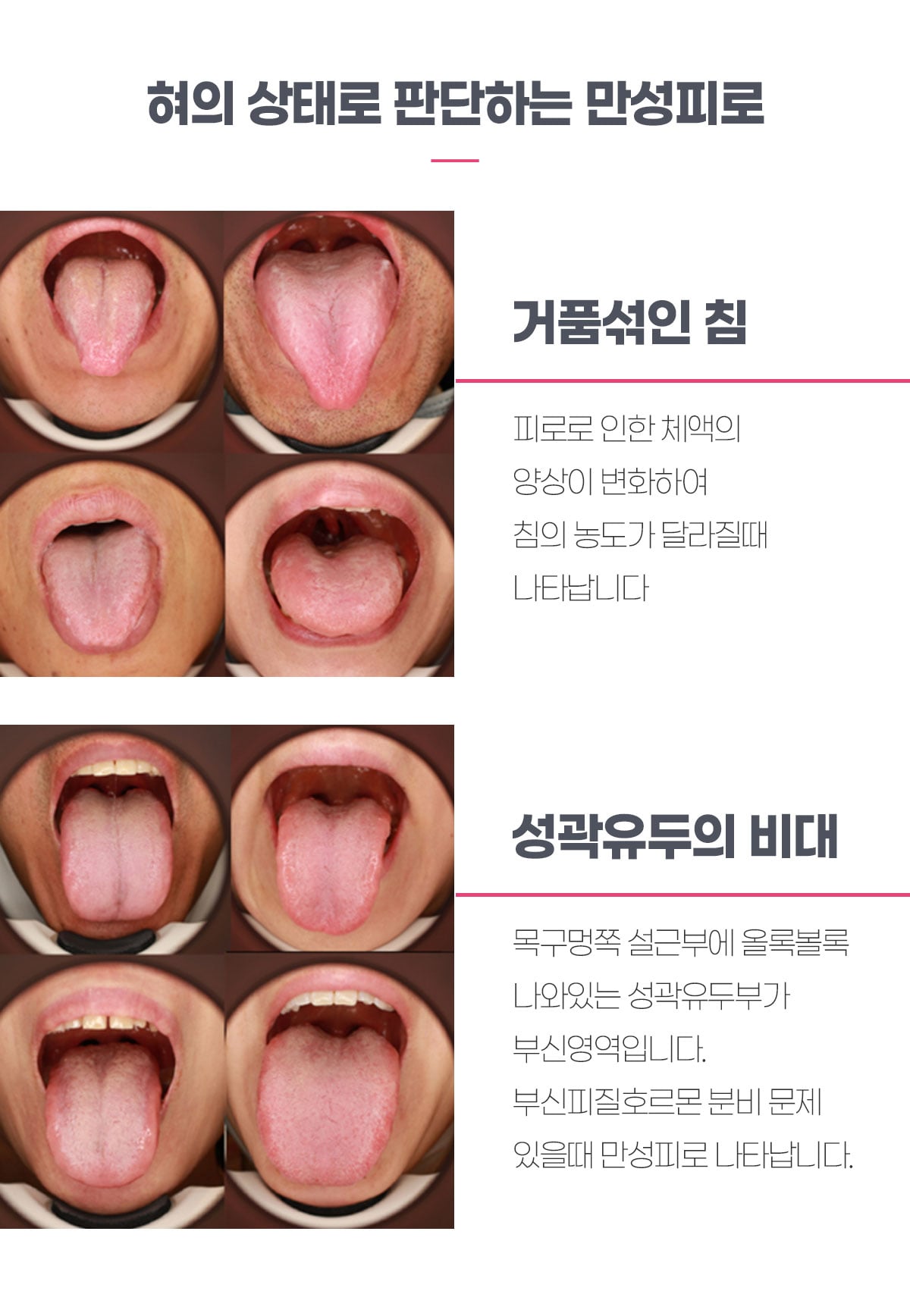 혀 상태로 자가체크