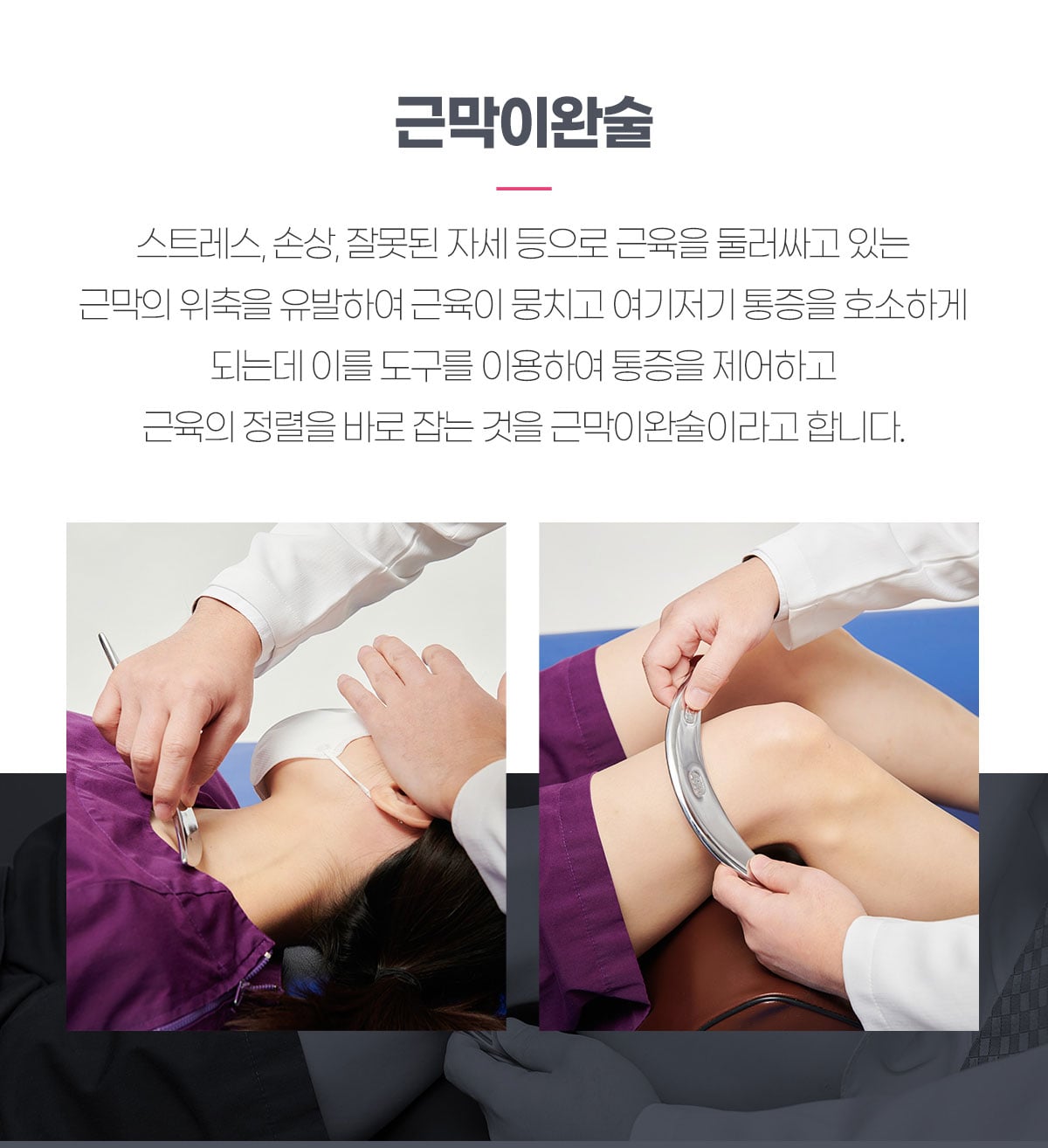 근막이완술