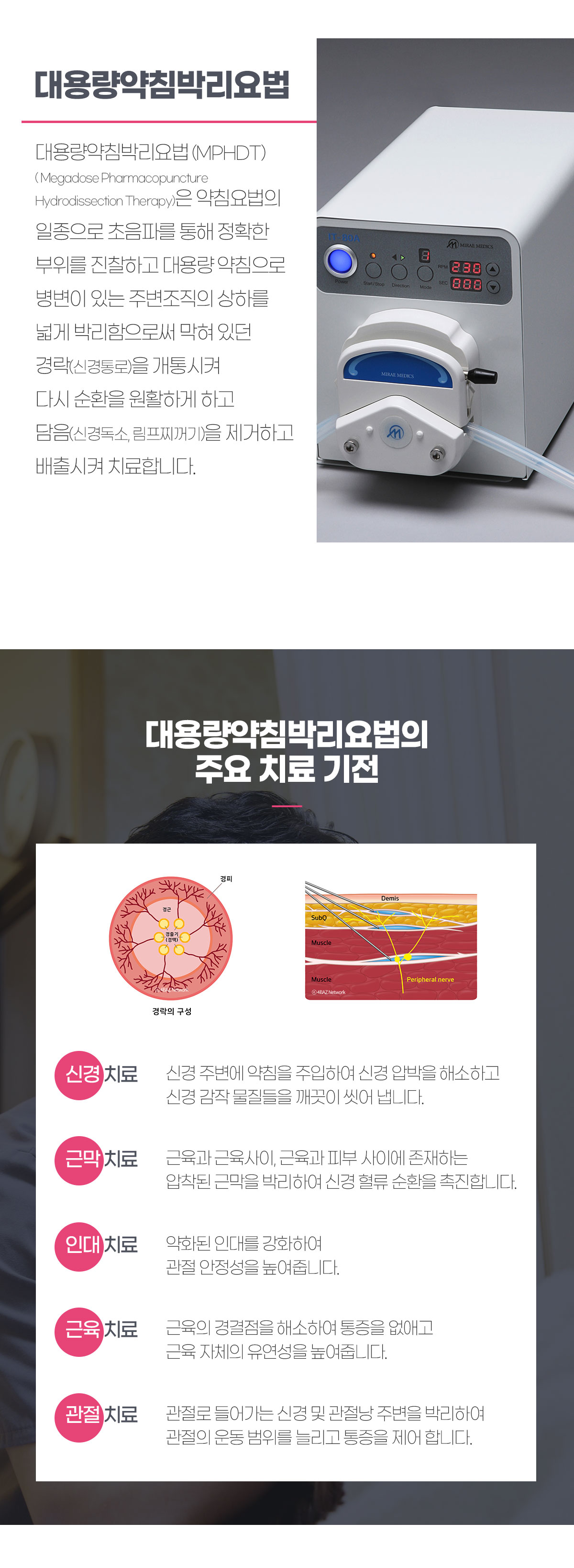 대용량약침박리요법