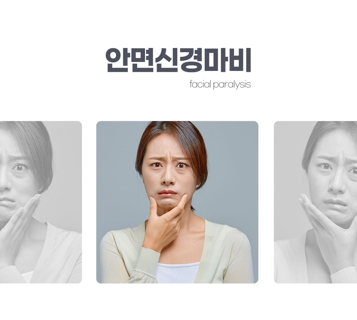 안면신경마비(구안와사) 클리닉
