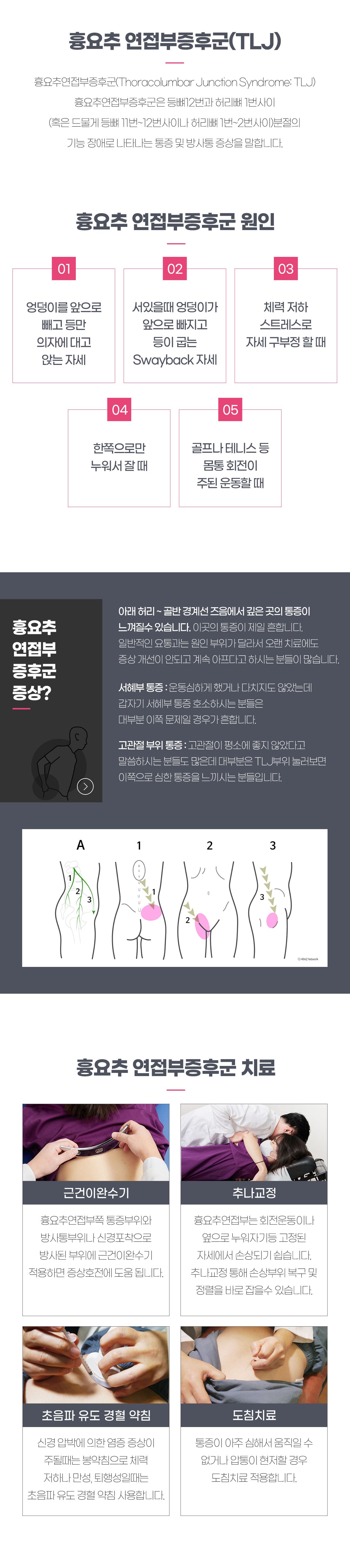 흉요추 연접부증후군(TLJ)