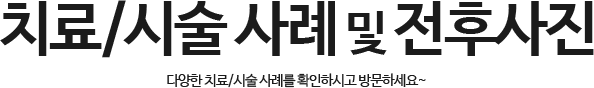 치료후기 및 사례 개시판 타이틀 이미지