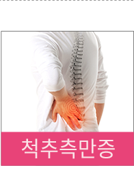 척추측만증