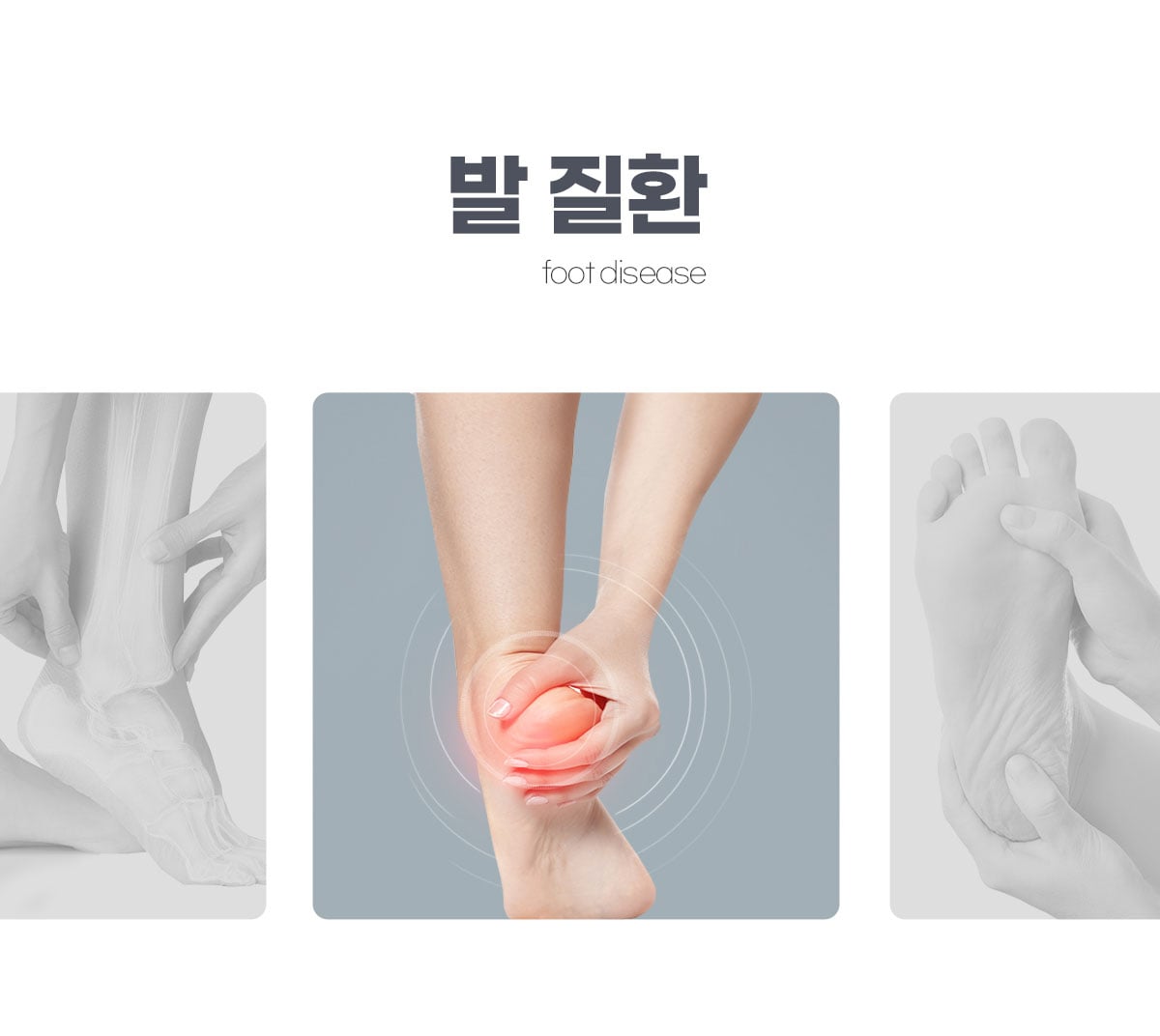 발 통증/족부 질환-발바닥근막염(족저근막염),아킬레스건염,발목염좌,발목터널증후군(족근관증후군),지간신경종(족지) : 통증/교통 ...